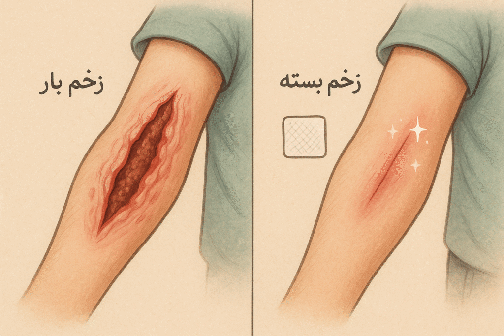 زخم بازو بسته انواع زخم