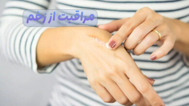 مراقبت از زخم