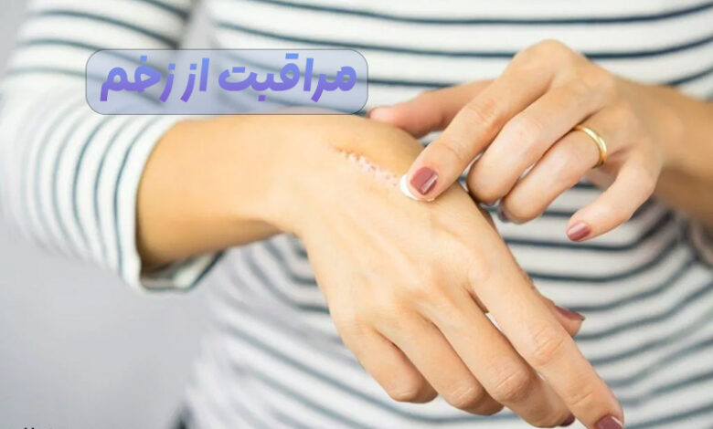 مراقبت از زخم