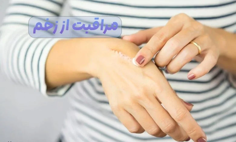 مراقبت از زخم