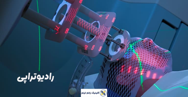 رادیو تراپی