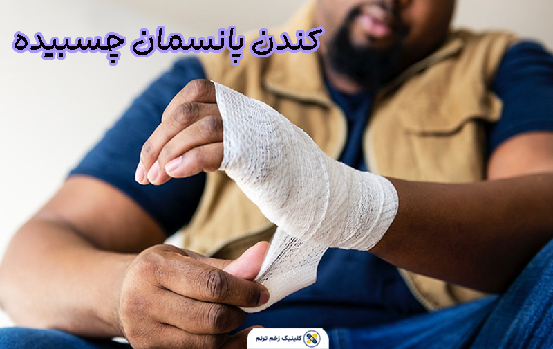 کندن پانسمان چسبیده