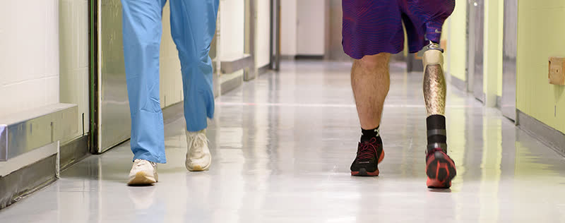 آمپوتاسیون