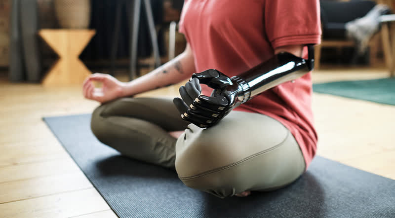 آمپوتاسیون