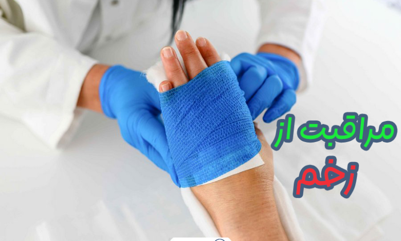 مراقبت از زخم