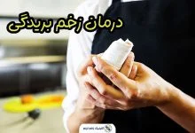 درمان زخم بریدگی