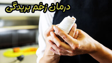 درمان زخم بریدگی