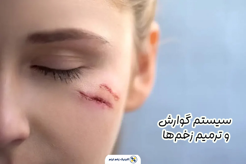 ترمیم زخم