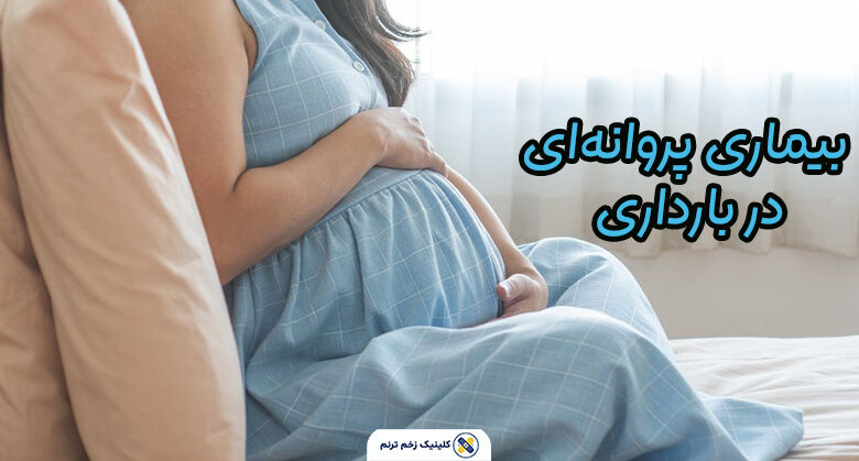 بیماری پروانهای در بارداری