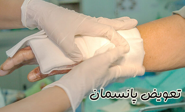 تعویض پانسمان