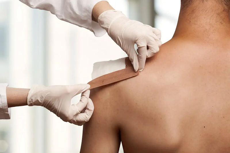 تعویض پانسمان