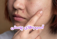 آسیب‌‌های پوستی