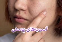 آسیب‌‌های پوستی