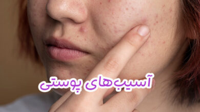 آسیب‌‌های پوستی