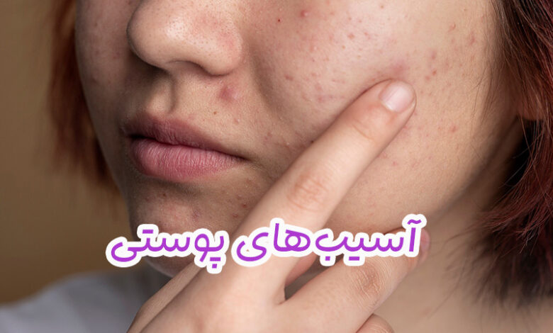 آسیبهای پوستی