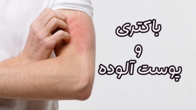 عفونت پوستی