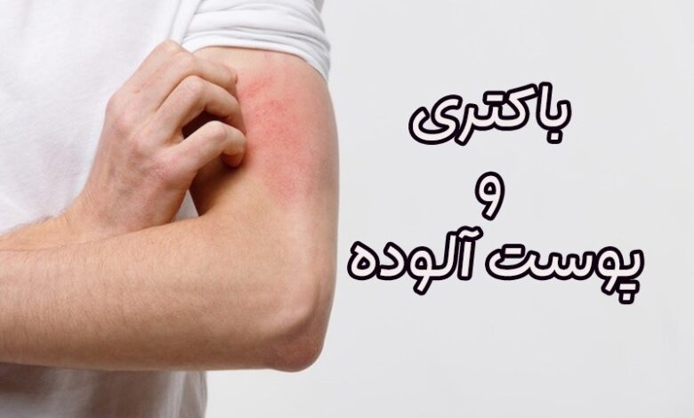 عفونت پوستی