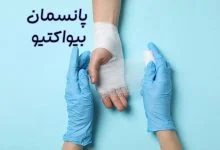 پانسمان بیواکتیو