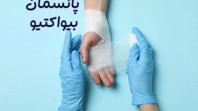 پانسمان بیواکتیو