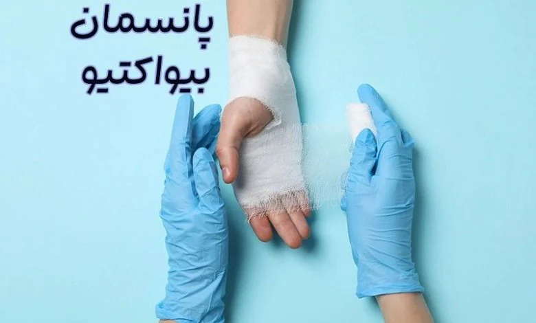 پانسمان بیواکتیو