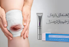 درمان زخم باز در خانه