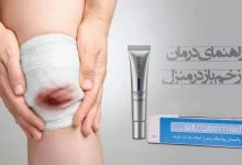 درمان زخم باز در خانه