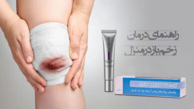 درمان زخم باز در خانه