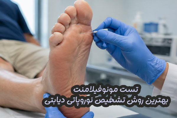 تست مونوفیلامنت