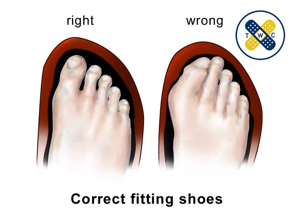 نکاتی برای انتخاب کفش مناسب