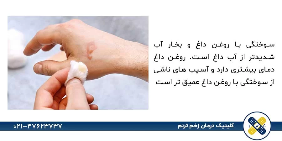 "علت