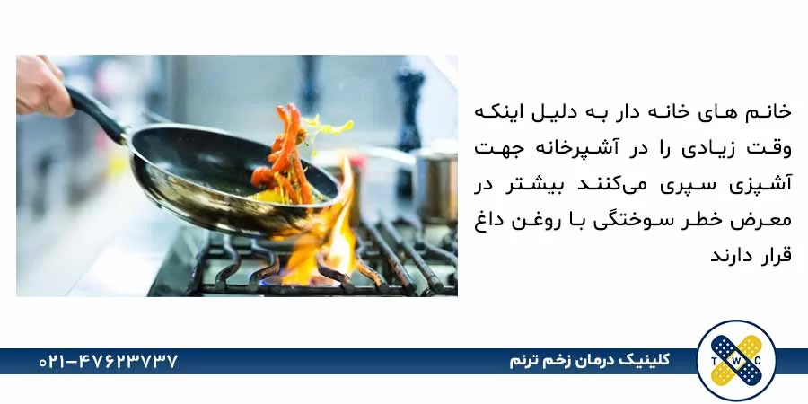 سوختگی با روغن داغ