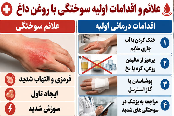 سوختگی با روغن داغ