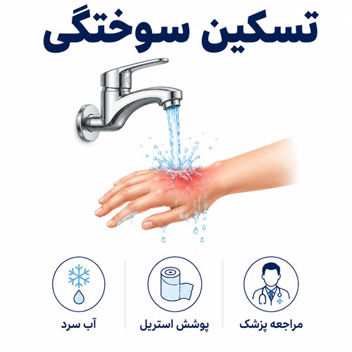 تسکین سوختگی