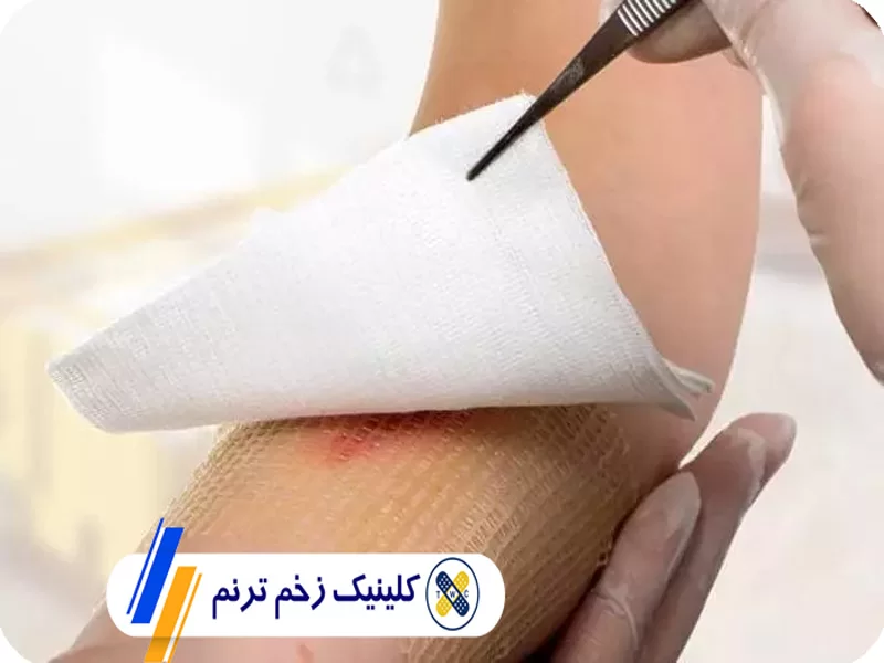 پانسمان نوین یا سنتی؟ تفاوت‌ها و مزایای هر کدام