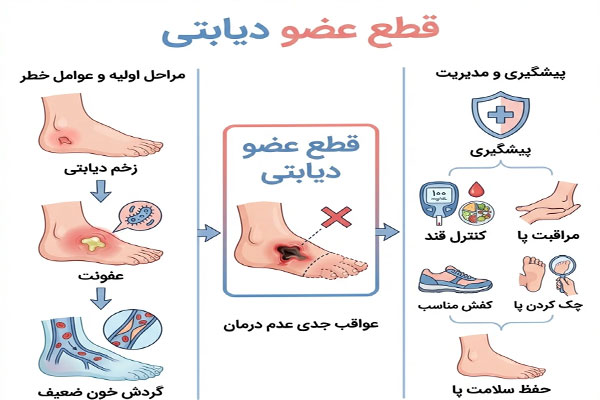 دیابتی قطع عضو دیابتی