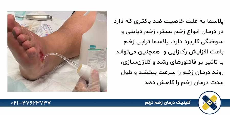 پلاسما تراپی زخم و فواید پلاسما برای زخم