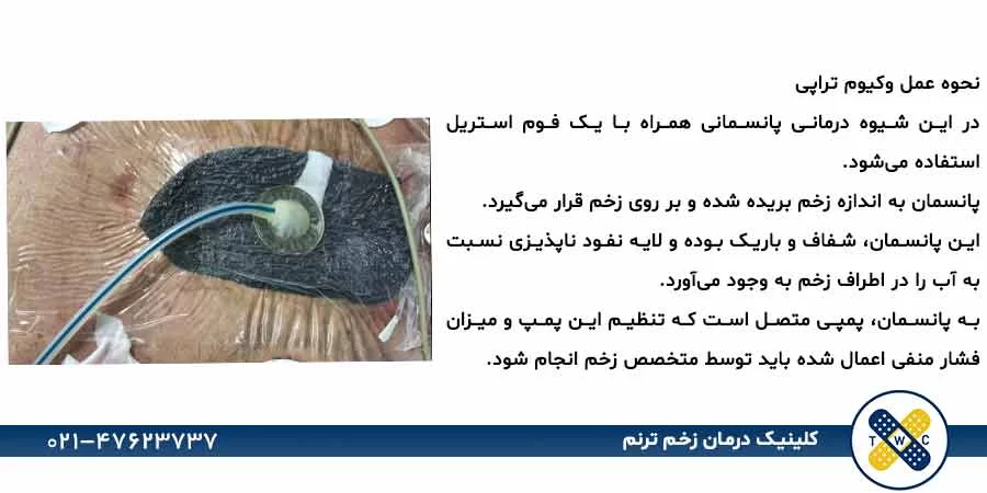 "نحوه