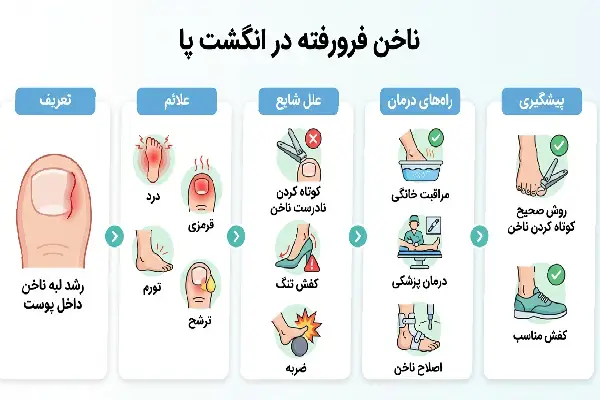ناخن فرو رفته در انگشت پا 