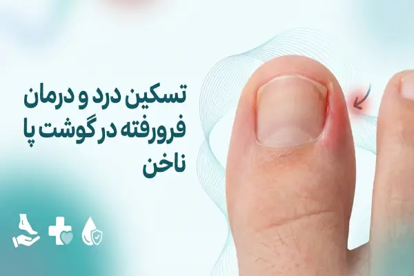 ناخن فرورفته در پا