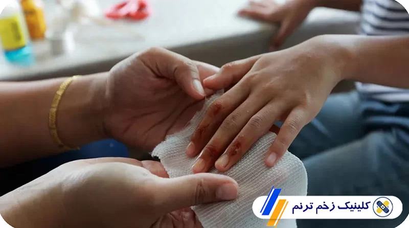 روش های درمان بافت زخم 
