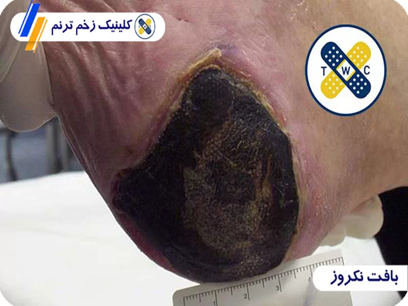 بافت اسلاف