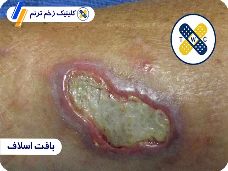 بافت اسلاف