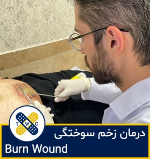متخصص زخم سوختگی