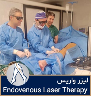 زخم واریسی درمان