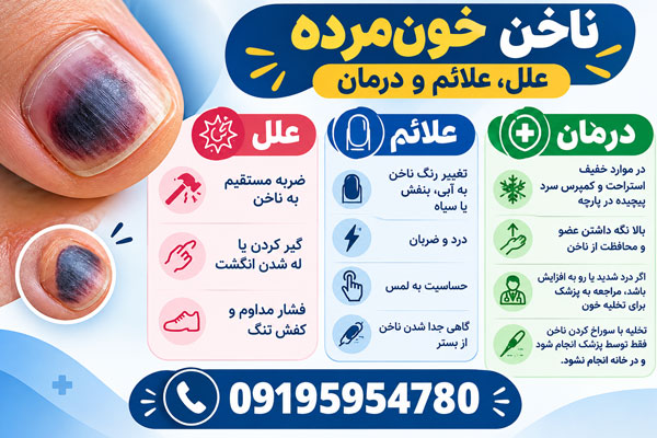 ناخن-خون-مرده ناخن خونمرده
