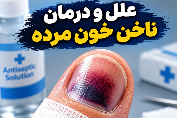 ناخن خون مرده